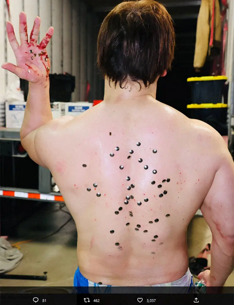 飯伏幸太のツイッターから（@ibushi_kota）。画鋲が刺さったバックショット