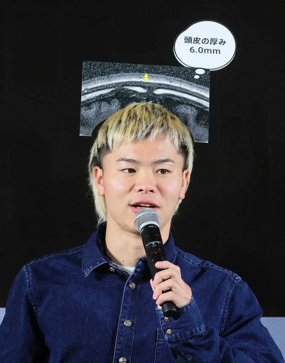 ＜スカルプD「いい頭皮の日」制定記念発表会＞自身の頭皮のMRI画像を頭に乗せてトークする那須川天心（撮影・尾崎　有希）